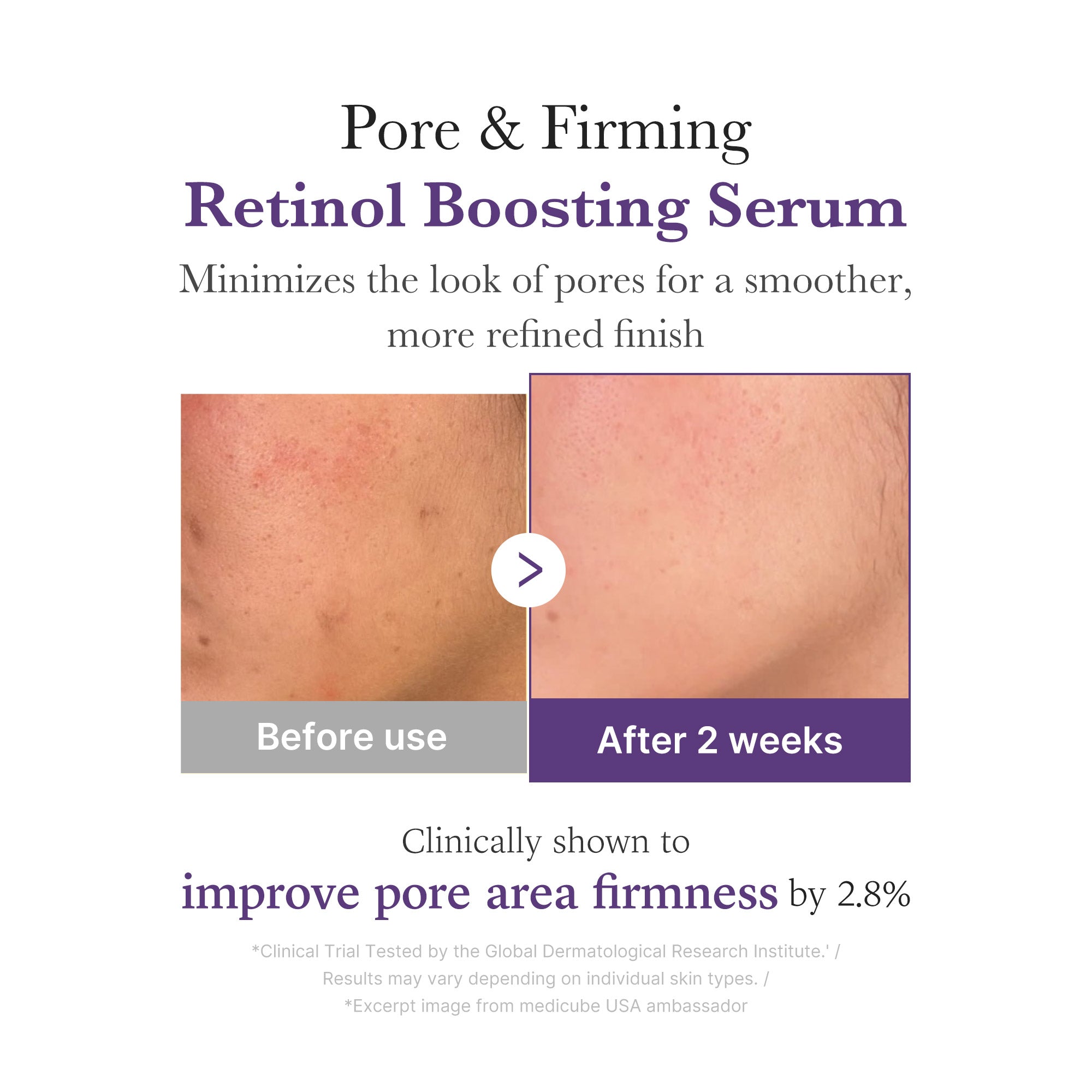 serum wzmacniające retinol nmn